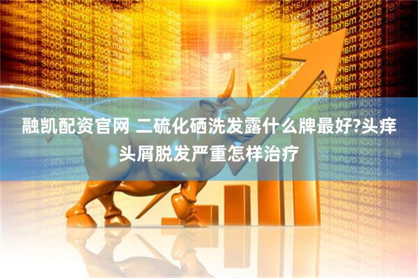 融凯配资官网 二硫化硒洗发露什么牌最好?头痒头屑脱发严重怎样治疗